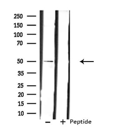 LPCAT2 Antibody