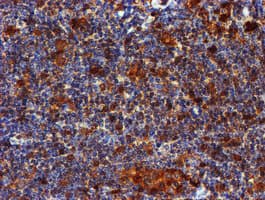 LIMK1 / LIMK Antibody (clone OTI6B4)
