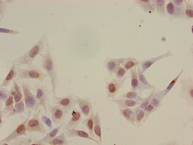 HIST1H2BB Antibody
