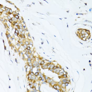 Polyclonal Rabbit anti-Human Dynactin 2 / Dynamitin Antibody (IHC, IF, WB)