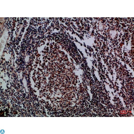 IL17D Antibody