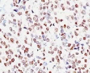 MITF Antibody (clone MITF/915, Ready-to-Use)