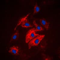 Polyclonal Rabbit anti-Human MAST4 Antibody (N-Terminus, IHC, IF, WB)