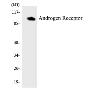 AR / Androgen Receptor Antibody (aa308-357)