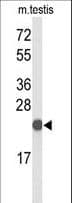 CXXC4 Antibody (aa158-185)