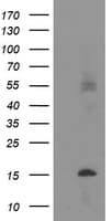 Monoclonal Mouse anti-Human TMEM230 Antibody (clone OTI3B2, WB)