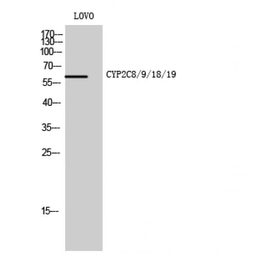 CYP2C8+9+18+19 Antibody (80-160 aa, Internal)