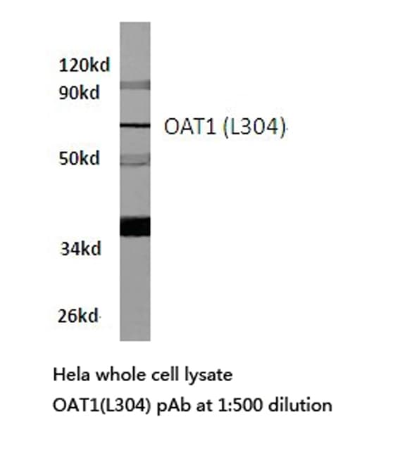 SLC22A6 / OAT1 Antibody (Leu304)