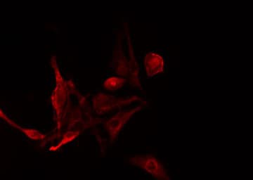 Polyclonal Rabbit anti-Human RGS14 Antibody (IF, WB)