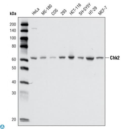 CHEK2 / CHK2 Antibody