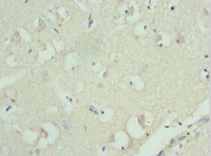 RPL9 / Ribosomal Protein L9 Antibody