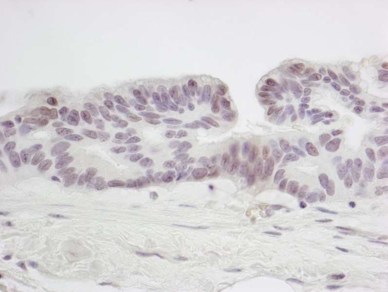 Polyclonal Rabbit anti-Human SMC6 Antibody (aa1050-C-term, IHC)