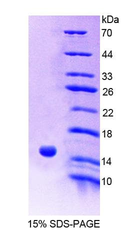 Human ACYP2 Protein (Recombinant His-T7)