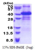 Human ING2 Protein (Recombinant His)