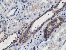 Monoclonal Mouse anti-Human ATG3 Antibody (clone OTI2C12, IHC, IF, WB)