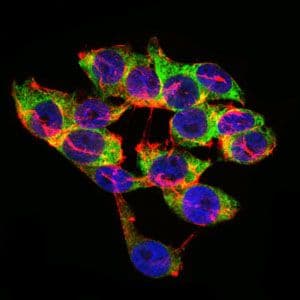 LPA / Lipoprotein a Antibody (Amino Acid: 4330-4521, clone 4H1)