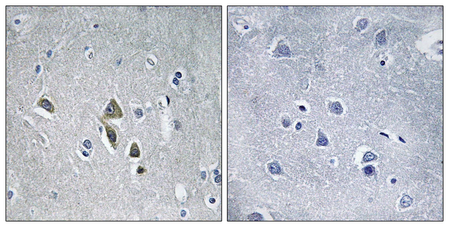 Polyclonal Rabbit anti-Human OAZ1 / OAZ Antibody (aa14-63, IHC)