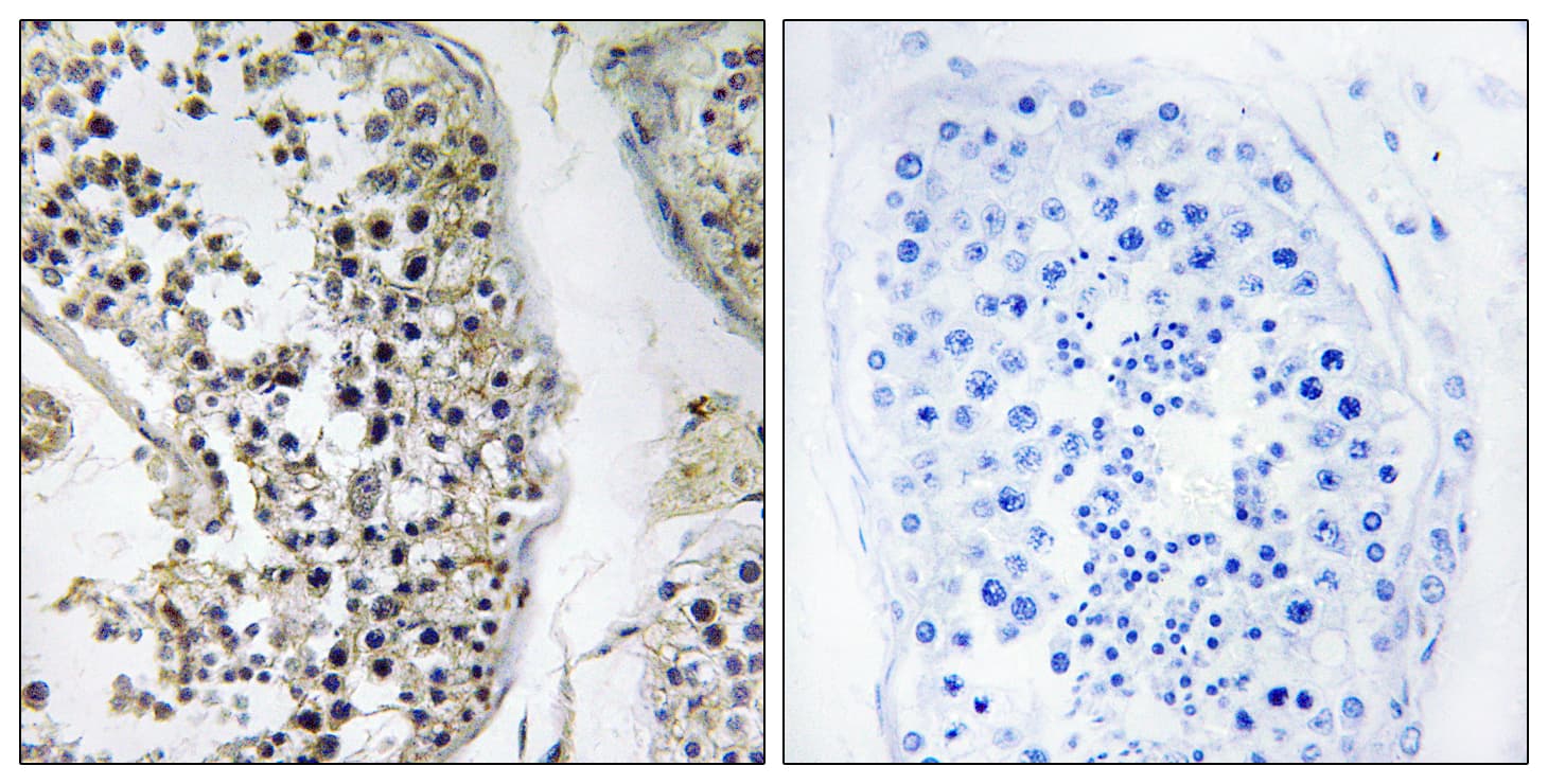 CEP170 Antibody (aa701-750)