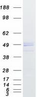 Human IIP45 / MIIP Protein (Recombinant Myc-DDK (Flag))