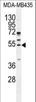 Polyclonal Rabbit anti-Human CCNB1 / Cyclin B1 Antibody (aa241-268, IHC, WB)