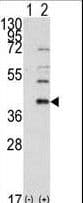 Polyclonal Rabbit anti-Human SAE1 Antibody (aa300-329, IHC, WB)