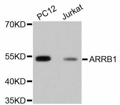 ARRB1 / Beta Arrestin 1 Antibody
