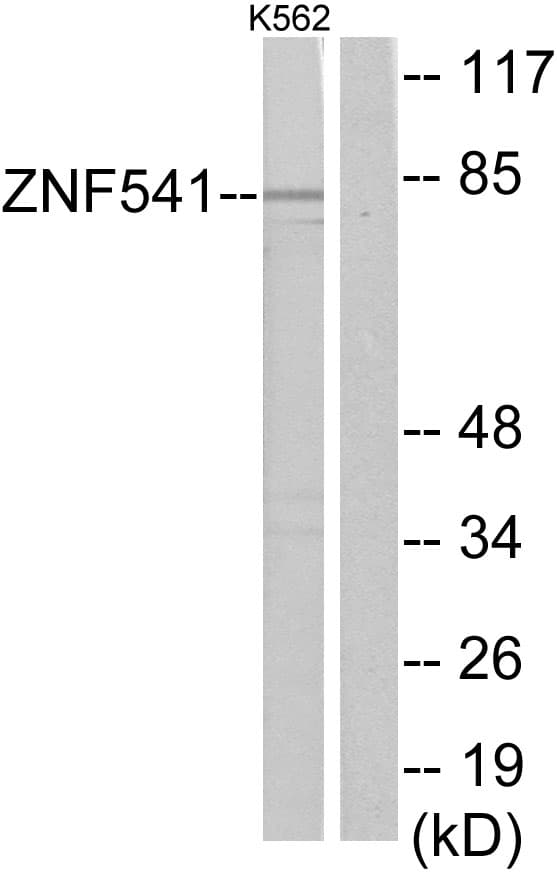 ZNF541 Antibody (aa931-980)