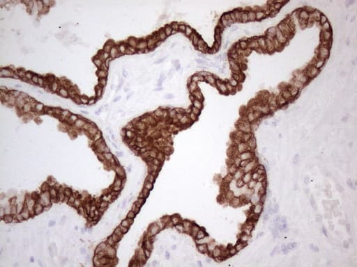 KRT16 / CK16 / Cytokeratin 16 Antibody (clone OTI2H8)