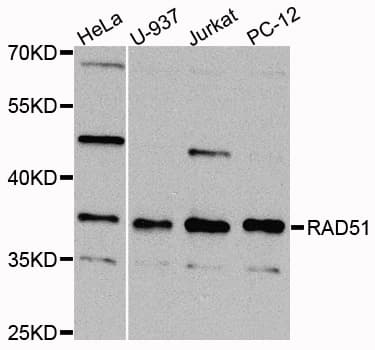 RAD51 / RECA Antibody