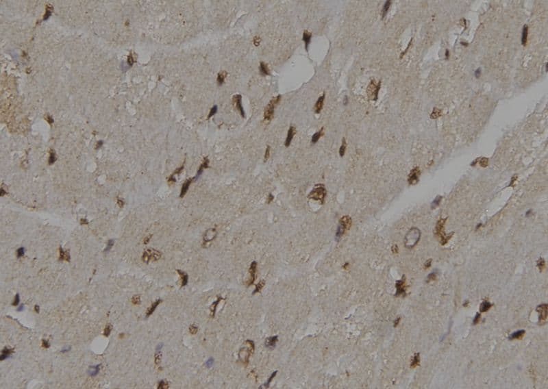 Polyclonal Rabbit anti-Human UBE2K / LIG Antibody (IHC, WB)