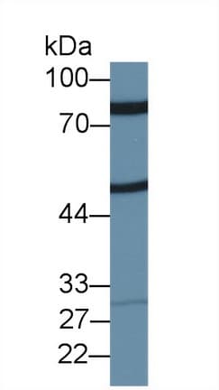ZP2 Antibody (aa353-616, PE)