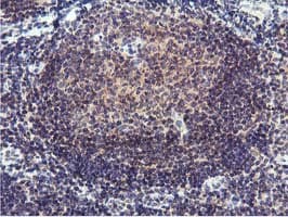 RFXANK Antibody (clone OTI3C10)