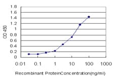 IHC-plus™ Monoclonal Mouse anti-Human PDZK1 Antibody (clone 1C3-2B11, IHC, WB)