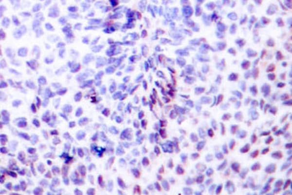 ATF2 Antibody (Gly56/39)