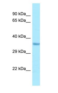 Polyclonal Rabbit anti-Human IMP4 Antibody (C-Terminus, WB)