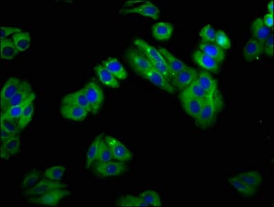Polyclonal Rabbit anti-Human SLC22A25 Antibody (IHC, WB)