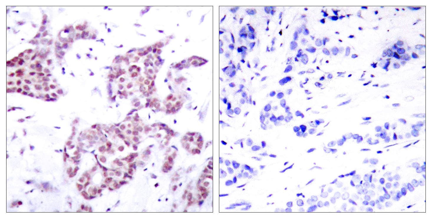 STAT6 Antibody (phospho-Tyr641)