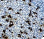 Monoclonal Mouse anti-Human CD68 Antibody (IHC)