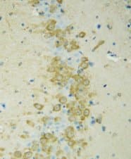 VR1 / TRPV1 Antibody (N-Terminus)