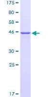Human COMMD3 / BUP Protein (Recombinant GST)