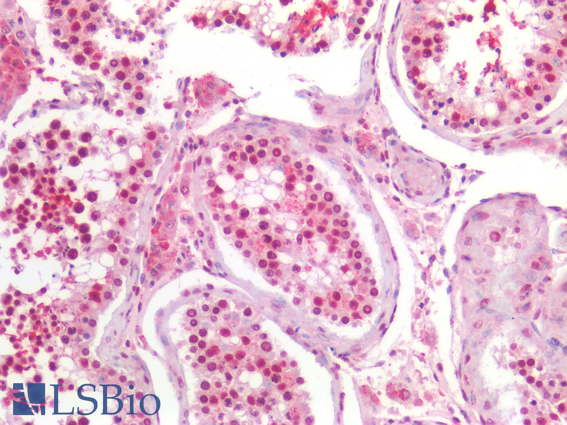 PathPlus™ CCNE1 / Cyclin E1 Antibody (C-Terminus)