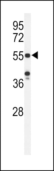 Polyclonal Rabbit anti-Human POTEH Antibody (aa32-60, WB)