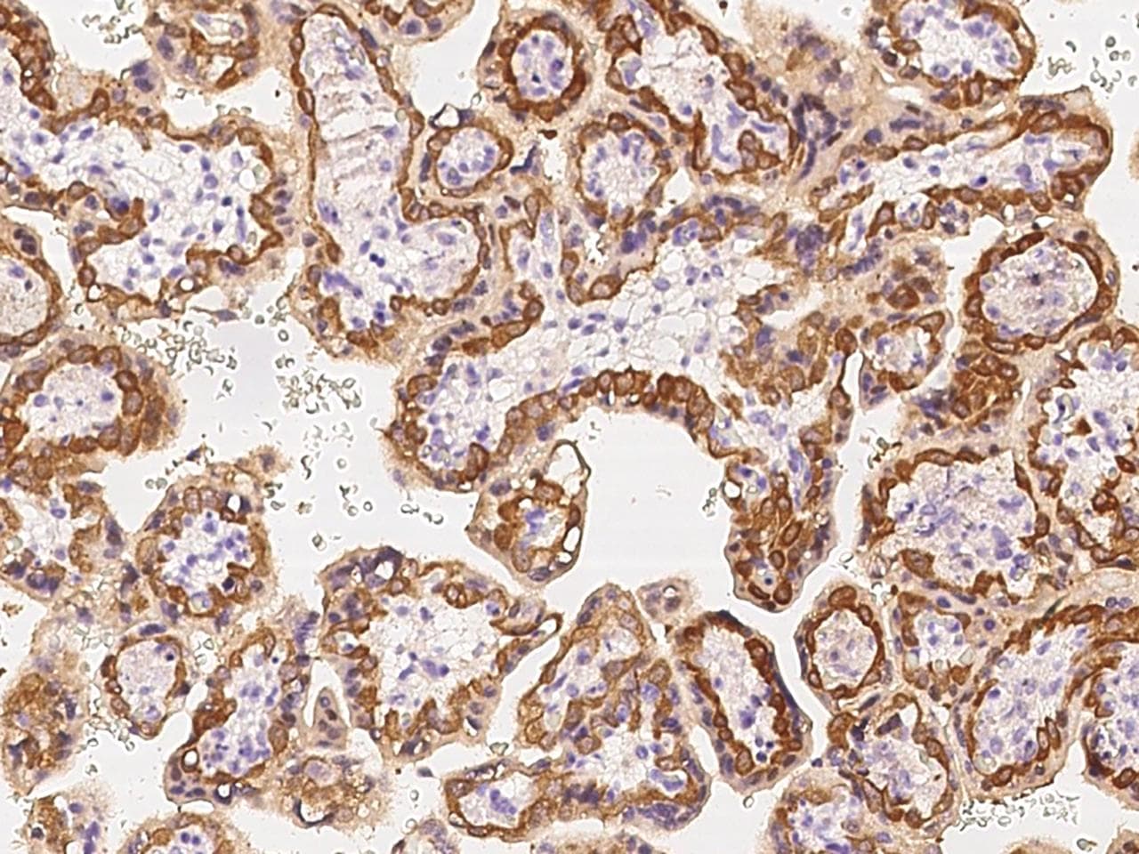 SLC1A5 / ASCT2 Antibody