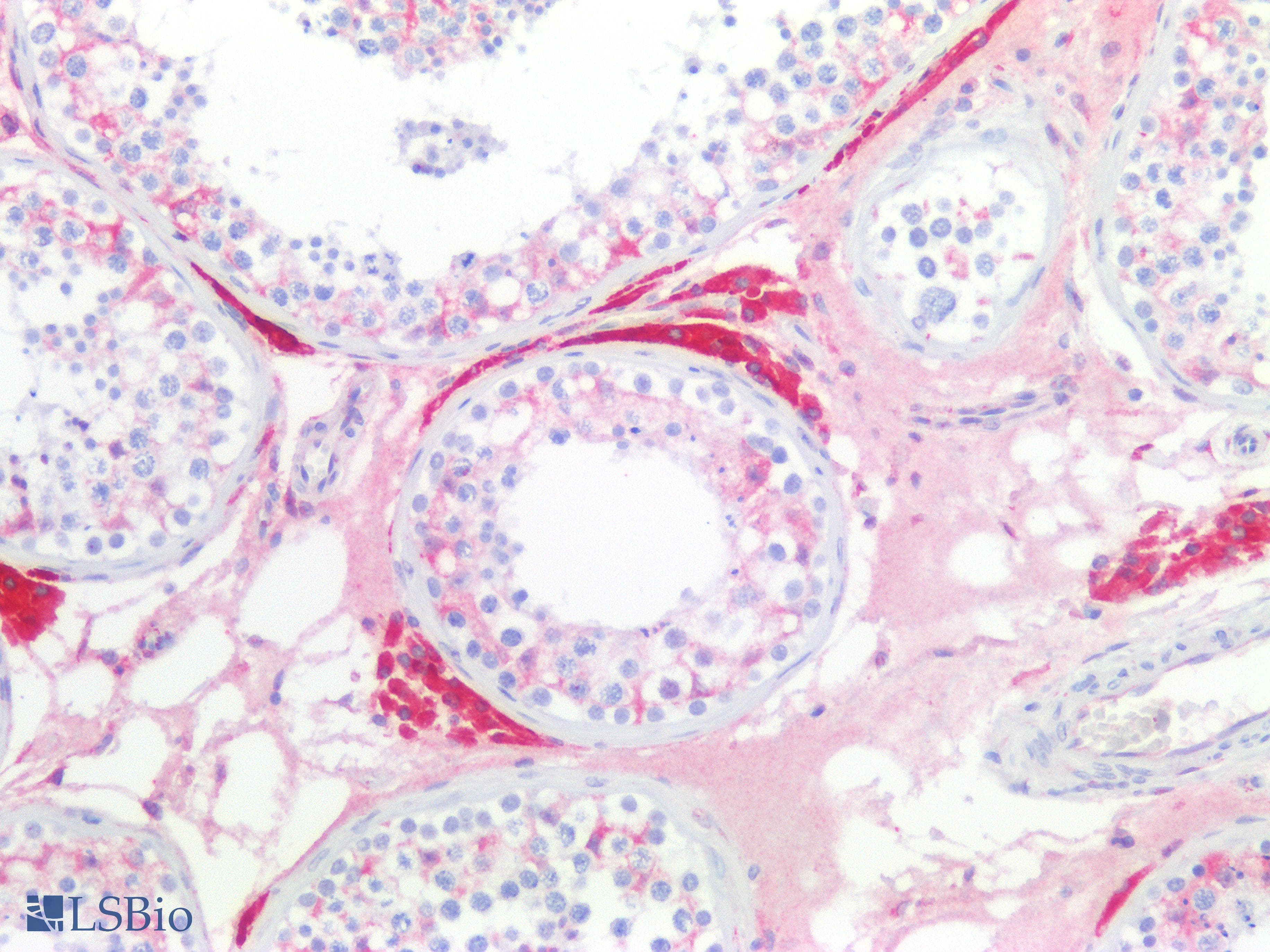 PathPlus™ Polyclonal Rabbit anti-Human EPHX1 / Epoxide Hydrolase 1 Antibody (IHC, WB)