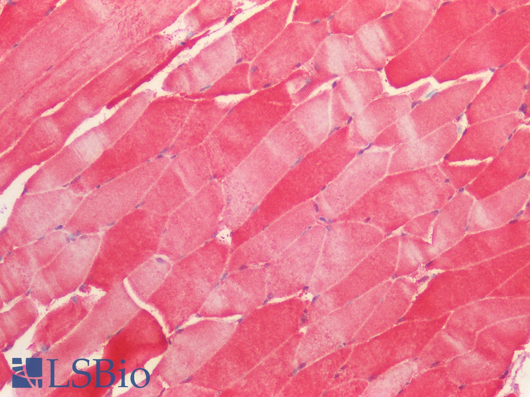 VPS4A Antibody