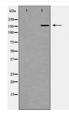 Polyclonal Rabbit anti-Human CUX1 / CASP Antibody (WB)