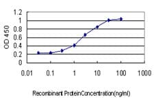 VPS72 Antibody (clone 2G6)