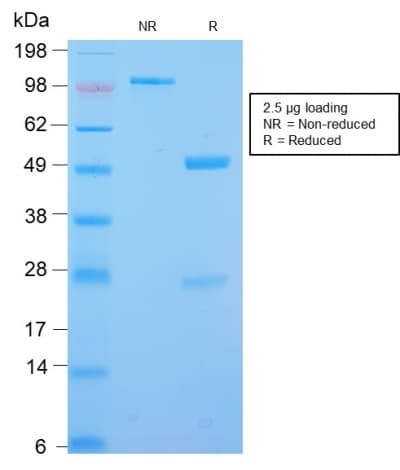 PathPlus™ DES / Desmin Antibody (clone DES/2960R)