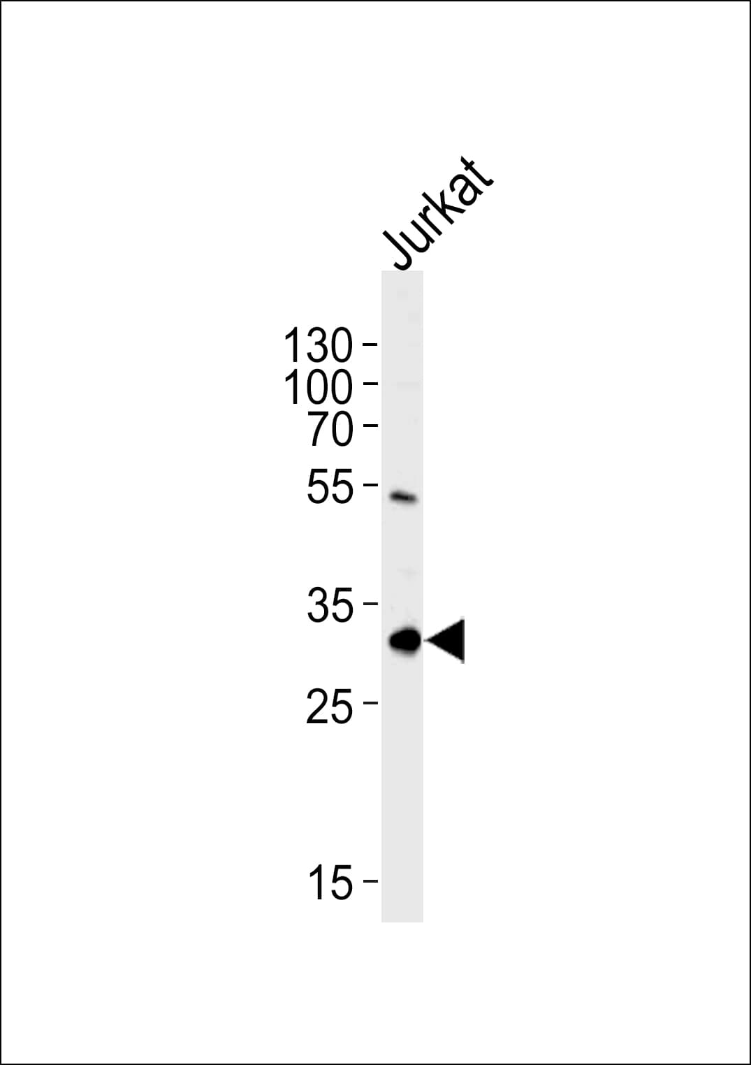 EXOSC2 / RRP4 Antibody (aa1-30)