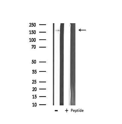 c-Kit / CD117 Antibody